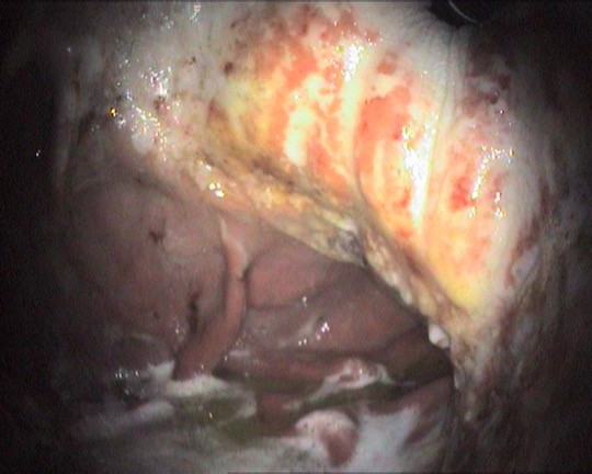 Equine Gastric Ulceration Syndrome