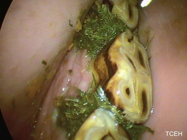 horse dentistry